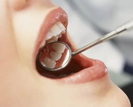 Canadian Dental Care Plan